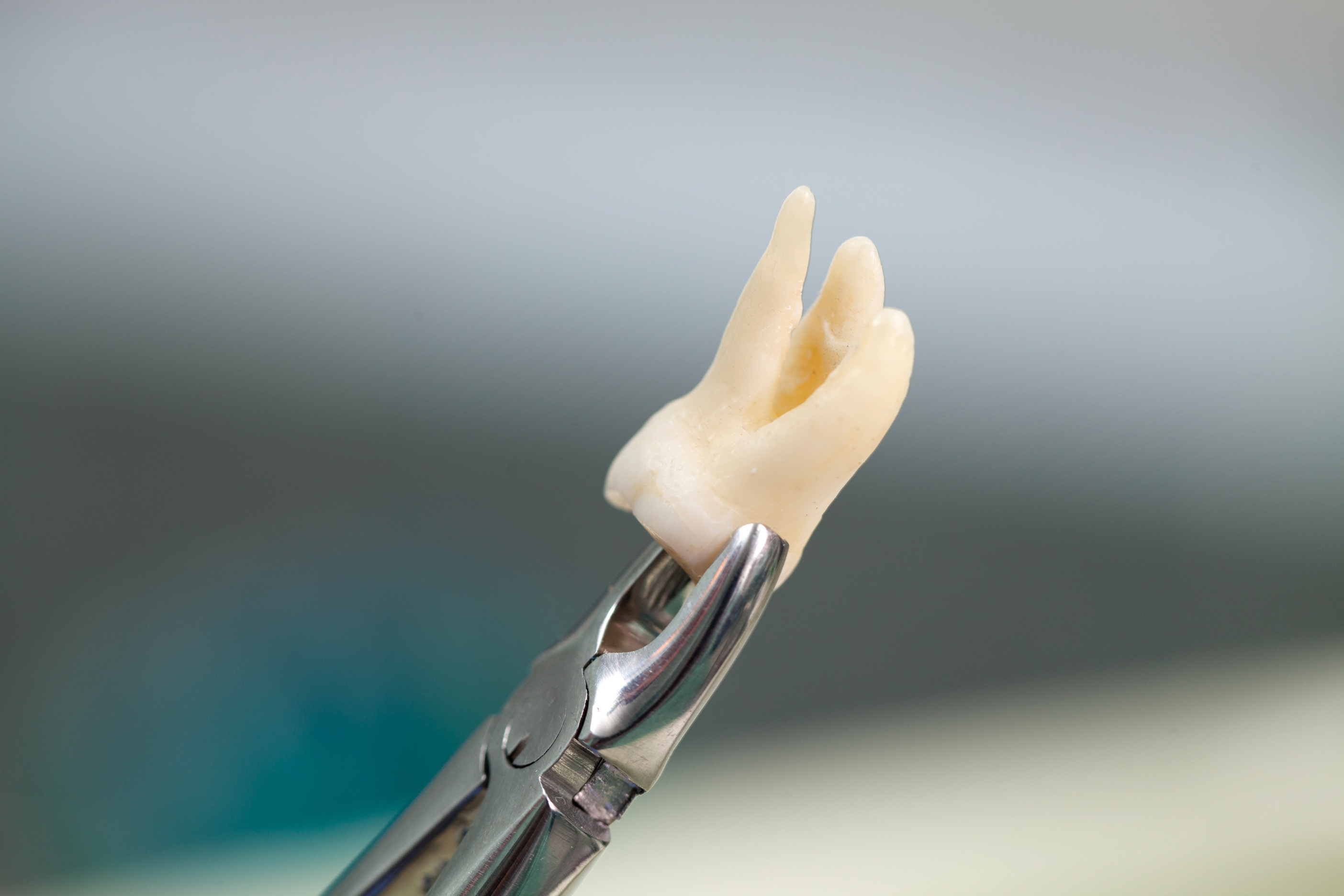 Extracted tooth